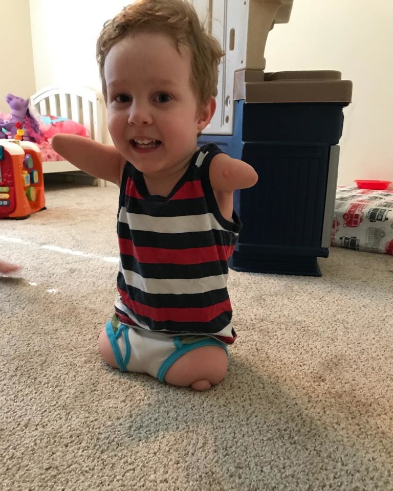 Four Years After This Boy Was Born Without Limbs He Achieved A Feat